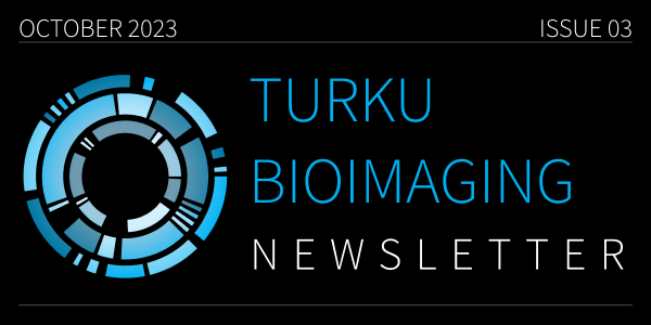 TBI Newsletter