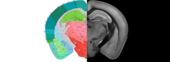 Euro-BioImaging ISIDORe project “Automatic pipeline for brain autoradiography image analysis”