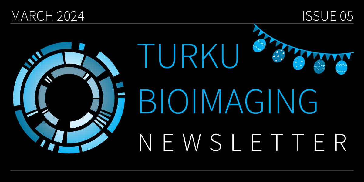 The March edition of TBI Newsletter