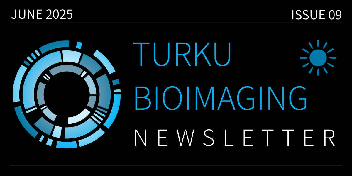 TBI Newsletter – June 2025